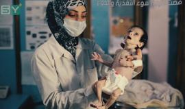"سحر" ليست الأولى.. سوء التغذية يحصد أطفال غوطة #دمشق الشرقية #المحاصرة