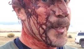 #شاهد أمريكي من (اينيس - مونتانا)‏ في الولايات المتحدة ينشر فيديو على فيس بوك عقب مهاجمته من قبل دب!