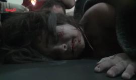 مشهد مؤثر لطفلة سورية أصيبت بالقصف المدفعي من قوات النظام على مدينة تلبيسة بريف #حمص الشمالي