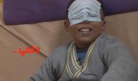 كم من طفل مثل يزن خسر حياته وفقد حلمه بعد أن فقد بصره أو أحد حواسه بقصف أو لغم أو تفجير ! 
(منصة)

#سوريا #حلب #أطفال_سوريا