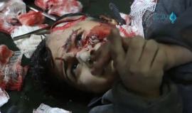 مؤثر .. شهداء وجرحى بقصف الطيران الحربي على مدينة سقبا في غوطة دمشق