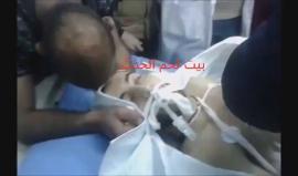 رصاص جيش الاحتلال يخترق قلب الشهيد قصي العمور (17 عاما) والذي استشهد بمواجهات تقوع في بيت لحم اليوم