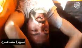 " على الفاضي .. وحنرجع " 
#شاهد كلمات مصاب برصاص الاحتلال خلال نقله للمستشفى بسيارة إسعاف من شرق جباليا شمال القطاع .