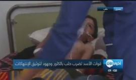 #شاهد .. قوات الأسد تستدهف #حلب بالغازات السامة . 

تقرير يمان خطيب 
تصوير مجاهد ابو الجود