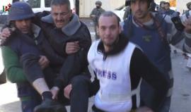 #شاهد لحظة اصابة الناشط في تجمع المدافعين عن حقوق الانسان في باب الزاويه بمدينة الخليل أثناء أقتحمها من قبل جنود الاحتلال بعد ظهر اليوم وتم نقله الى مستشفى الخليل الحكومي لتلقي العلاج