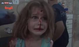 مشهد مؤثـر يجسد معانـاة أطفـال سوريا من قنابـل الطيران !