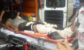 #شاهد لحظة وصول شاب مصاب بطلق ناري متفجر في القدم لمستشفى شهداء الأقصى وسط القطاع
تصوير: حازم مزيد