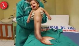 #شاهد 15 طفلاً لن تصدق أنهم موجودون في العالم!

أطفال يولدون بحالات غريبة ونادرة، بعضها يكون قد تسبب فيه فيروس ومرات يعود الأمر إلى أسباب جينية أو وراثية

وهناك من يمكن معالجته عبر العمليات الجراحية، في هذا الفيديو نتعرف على 15 حالة نادرة يعاني منها أطفال