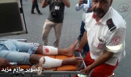 #شاهد | وصول عدد من الاصابات الى مستشفى شهداء الأقصى جراء إعتداء قوات الاحتلال على مسيرة العودة شرق البريج .

تصوير مراسلنا | حازم مزيد