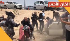 لتُكسر اليد التي تمتد على نساء فلسطين...لتُقطع اليد التي تقوم بخلع حجابهن..
#الخان_الأحمر