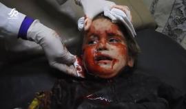 مشاهد قاسية.. أطفال ضحايا قصف قوات النظام السوري على بلدة الغنطو بريف #حمص الشمالي