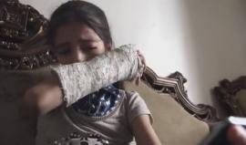 فيلم - ضحى 
ضحى المحمد طفلة سورية من مدينة حلب، أصيبت مع عائلتها بقصف مروحي استهدف منزلهم في شهر نيسان من العام الجاري. 

تماثلت ضحى بالشفاء وبقيت أختها الصغيرة "ياسمين" تتلقى العلاج في تركيا حتى اللحظة ليضاف شتات أفراد عائلتها فوق معاناتها وإصابتها.
Film