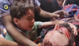 قصيدة - على حد الوجع #حلب .. 
أداء: حازم عبد الهادي 
#حلب_تباد