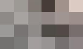 #شاهد ردة فعل هذا الشاب بعد تفعيل جهاز القوقعة وسماعه الصوت لأول مرة