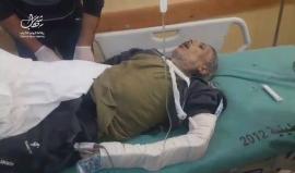 #شاهد من الإصابات اثر الغارات العنيفة التي شنتها طائرات الاحتلال على موقع يتبع كتائب القسام قرب ابراج الشيخ زايد شمال قطاع غزة.