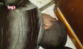 #شاهد
عشرات الشهداء ومئات الإصابات بعد قصف دوما السورية بالكيماوي.