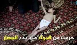#شاهد على لائحة الموت تنتظر .. روان و150 طفلاً آخرين في الغوطة الشرقية لدمشق بسبب الحصار المطبق.