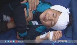 نجاح عمليات زراعة القوقعة للاطفال في #غزة على يد الوفد الطبي القطري . 

تقرير: إسراء الشريف