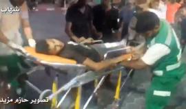 #عاجل إصابة جديدة تصل مستشفى الاقصى برصاص الاحتلال وسط قطاع غزة