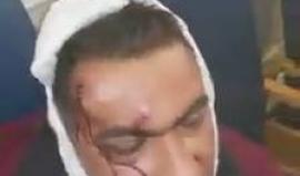 #شاهد مستوطنون يعتدون على سائق فلسطيني في القدس ويحاولون قتله ليلا

السائق يدعى "فادي عابد" سكان قرية شرفات في القدس المحتلة أصيب بجروح جراء الاعتداء وصفت بالخطيرة