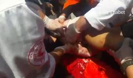 #فيديو اصابة مواطن برصاص الاحتلال خلال اعتداء الاحتلال على مسيرة العودة شرق البريج على حدود وسط قطاع غزة