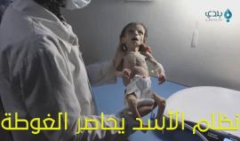 #الأسد_يحاصر_الغوطة.. الأسد قتل سحر ! 
(بلدي نيوز)