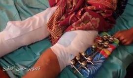 والد الفتى يوسف القطراوي يطالب بتحويل ابنه للعلاج في الخارج حيث يعاني من كسور متهتكة مضاعفة بعظام القدم جراء اصابته برصاص الاحتلال في مسيرة العودة