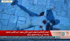 #مباشر الجلسة الافتتاحية للمؤتمر الدولي الثاني بعنوان "منبر الأقصى للخطباء والدعاة" في اسطنبول بتركيا