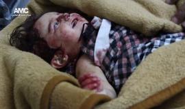 يحتوي على مشاهد قاسية +18 ..
إصـابة طفلين برصاص قوات النظام المتمركزة في حي الشيخ مقصود جنوبي #حلب 
مركز حلب الإعلامي