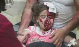 مشاهد مؤثرة: في يوم العيد.. الدماء تغرق أطفال #حلب وتحرمهم الفرحة كما أطفال العالم ! 
من القصف على حي الصالحين مساء اليوم
تصوير: عارف العارف