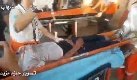 #شاهد وصول إصابة متوسطة برصاص الاحتلال إلى مستشفى الاقصى وسط قطاع غزة .