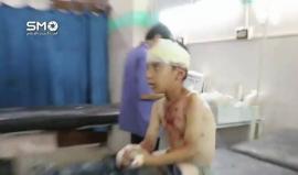#سوريا: عشرات الجرحى في #الغوطة_الشرقية بعد قصفها اليوم بالمدفعية الثقيلة من قبل قوات النظام