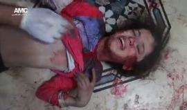 مركز #حلب الإعلامي: 10 شهداء وأكثر من 100 جريح بقصف جوي مكثف بالقنابل العنقودية والصواريخ للطائرات النظام وروسيا على أحياء حلب مساء اليوم (مشاهد قاسية +18).
تصوير: جواد الرفاعي