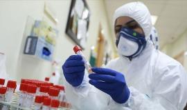 thumbs_b_c_57c90936a25a788e1e20c9c4e90937ae