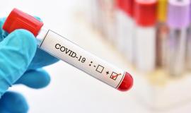 كورونا فلسطين