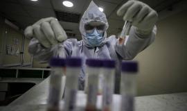 f281b219069e31ade45240d6c8948763