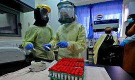 af2345b7eac399b9f8f5f9e697b4104d