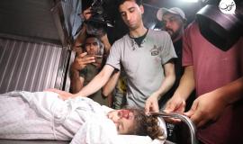 الطفلة الشهيدة ألاء قدوم 5سنوات