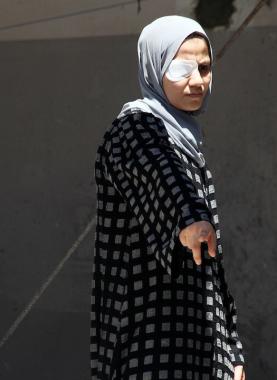 آلام الجسد وفقدان البصر.. كابوس سببه الاحتلال يُلاحق الشابة "إيمان"