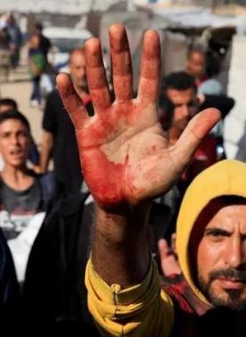 الاحتلال يرتكب مذابح يومية بحق طالبي المساعدات في غزة