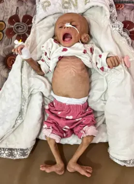 صورة تعبيرية