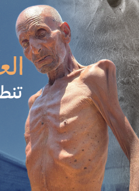 المسن سليم عصفور نازح في خان يونس ويعاني من سوء التغذية بسبب الحصار الإسرائيلي المستمر