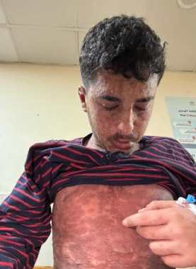 الشاب محمد ضبان