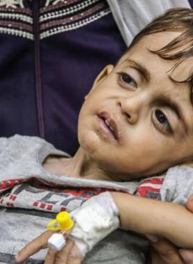 طفل فلسطيني محروم من علاج السرطان