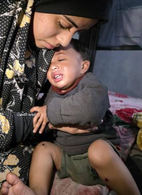 مهران لشهاب: تعذيب طفل عمره عام في غزة قمة الانحطاط الأخلاقي ويتطلب رداً دولياً حاسماً