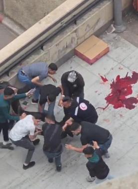 شهيد و4 إصابات برصاص الاحتلال خلال اقتحام نابلس