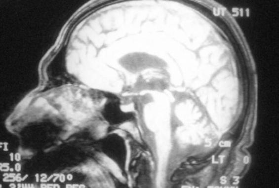 7f61e0f8-9199-4667-b0b0-111a49c4841e-1604779240