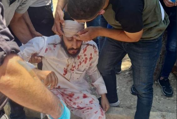 شاب فلسطيني اعتدى عليه جنود الاحتلال قرب باب الاسباط