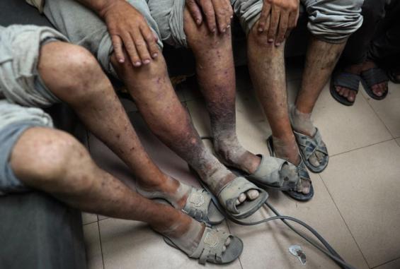 استمرار مسلسل التنكيل والحرمان