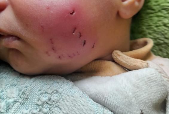 الرضيع آدم الأستاذ